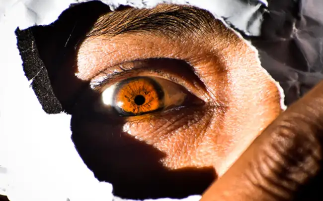 Olho Seco: É importante ficar alerta nos sintomas, mas a prevenção é o caminho.