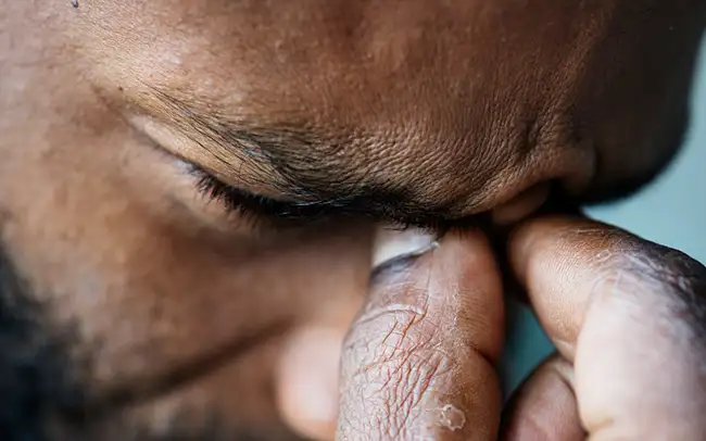 Olho seco, uma das síndromes que mais crescem no país.